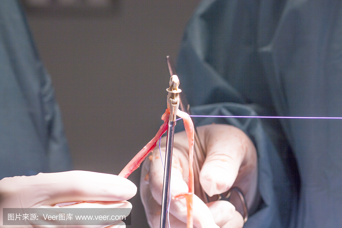 医院手术室急诊室创伤膝关节和骨科膝关节腱和