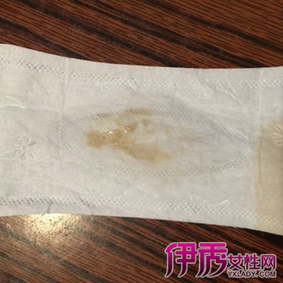 排卵期出现白带状果冻习水豆腐皮图片