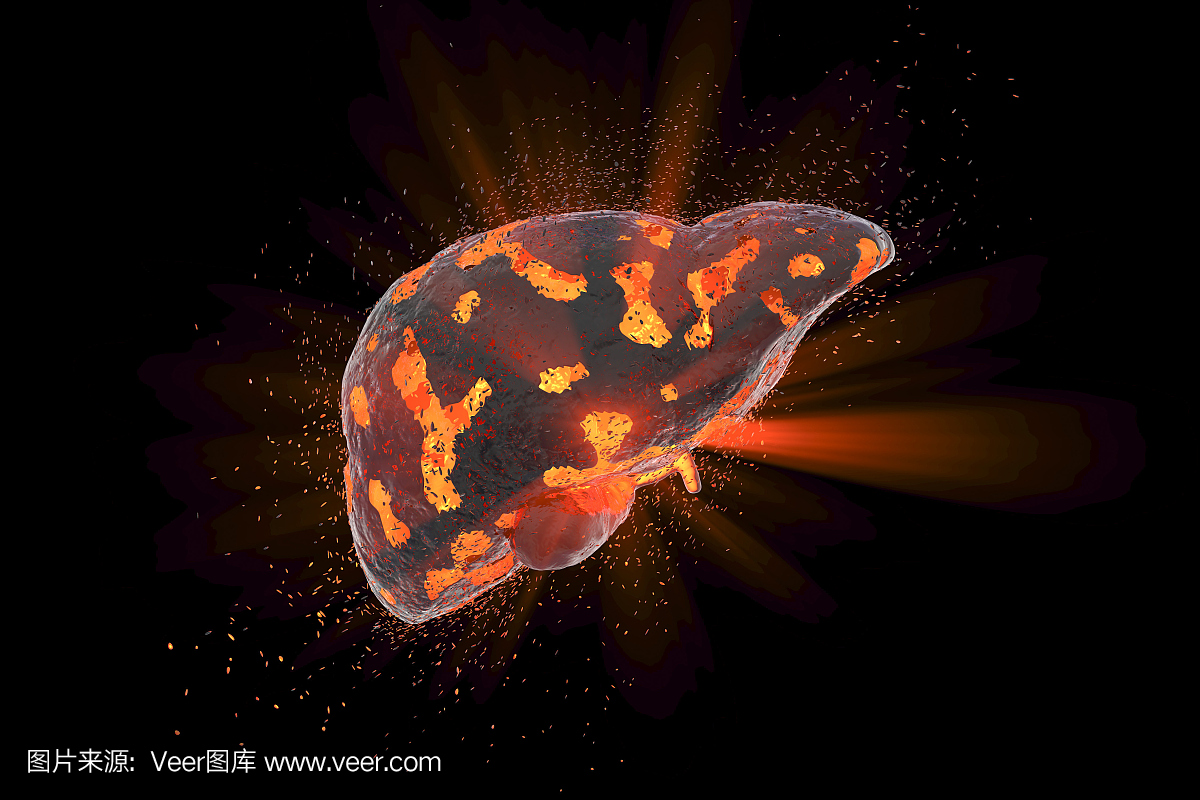 肝损伤的概念性图像