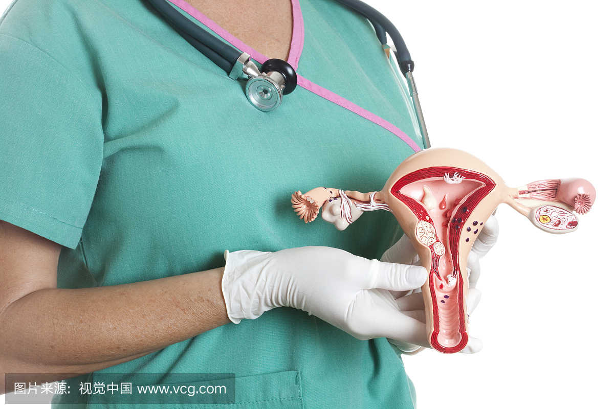 宫颈癌,宫颈腺癌,卵巢,子宫