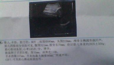 胎盘成熟几度可以生产_胎盘成熟二级多久会生_胎盘成熟度几级才能生