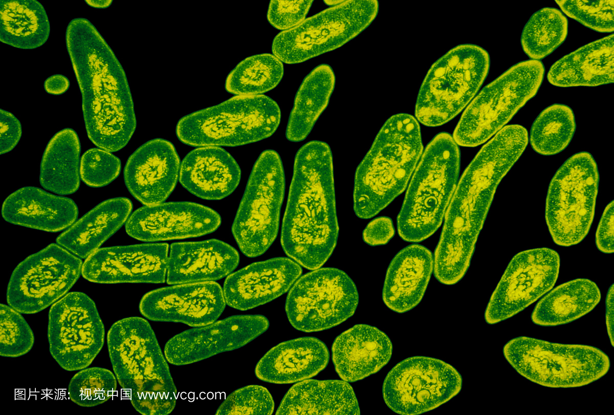 结核分枝杆菌的彩色增强透射电子显微镜(TEM