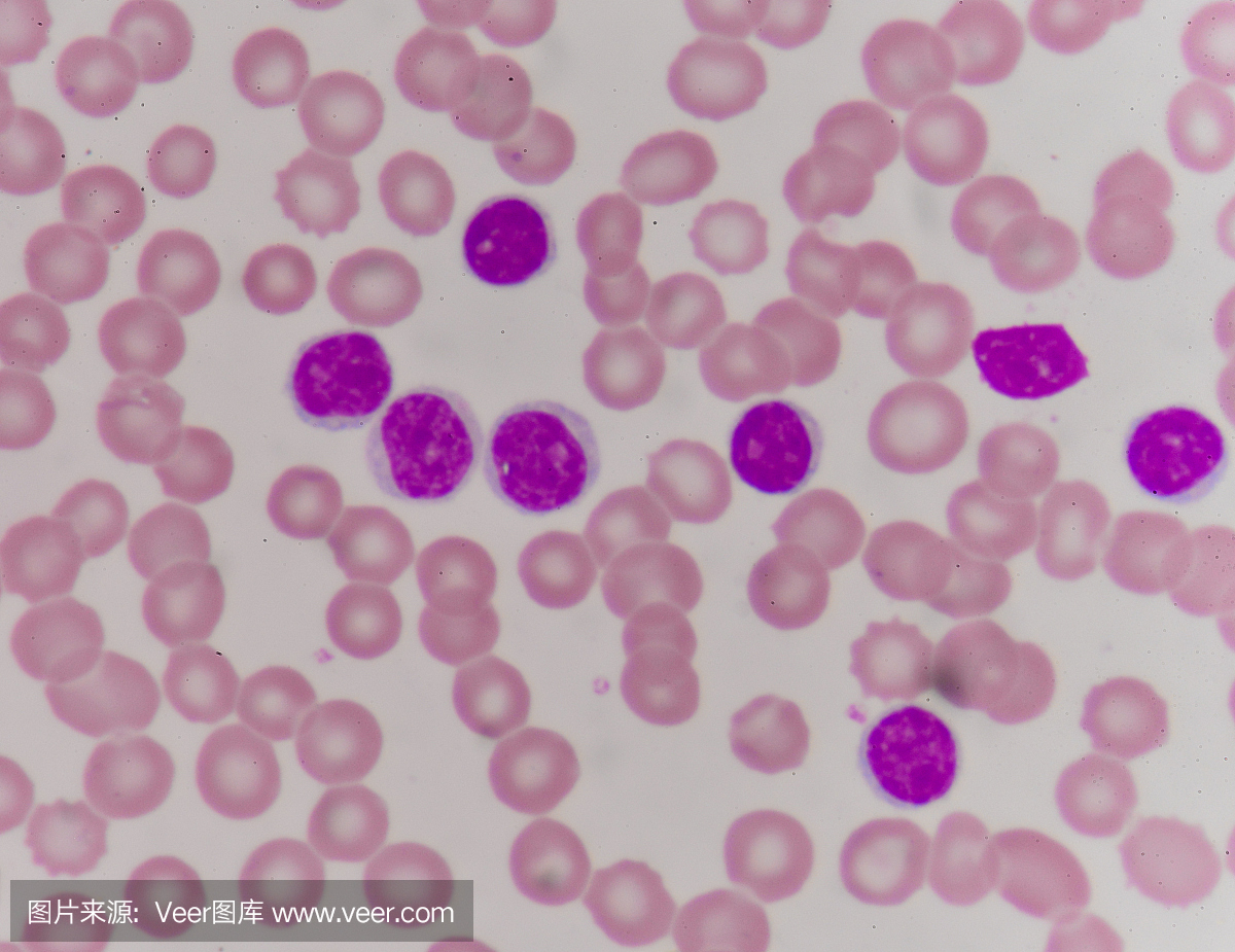 血液涂片通常用作对完全血细胞计数(CBC)的异