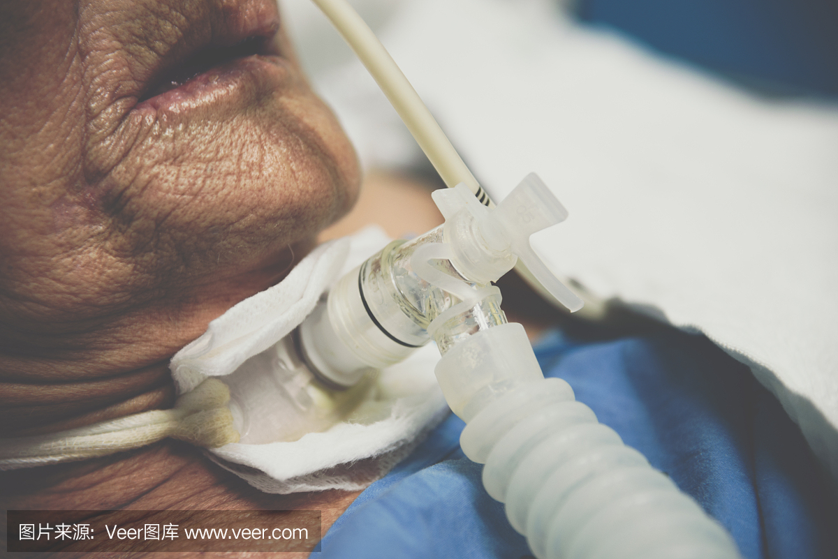 病人在医院做气管切开和呼吸机