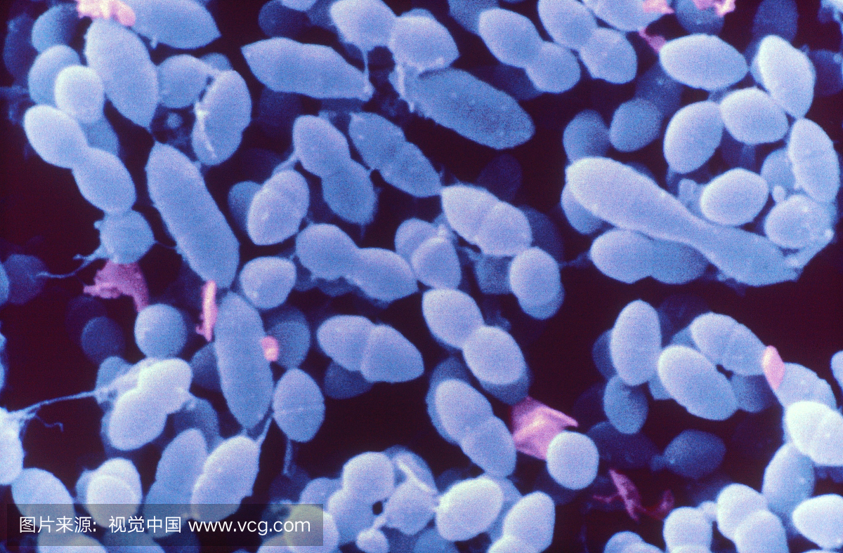 链球菌的电子显微照片。链球菌属细菌是土着人
