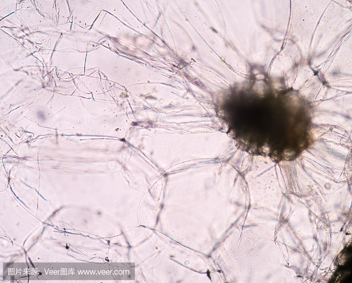 细胞死亡,死细胞,细胞失活,内质网