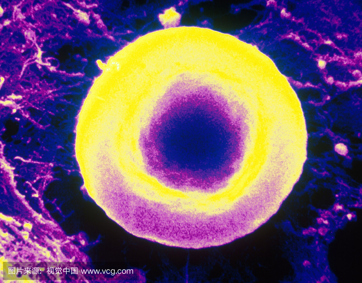等渗溶液中人红细胞的增强扫描电子显微照片。