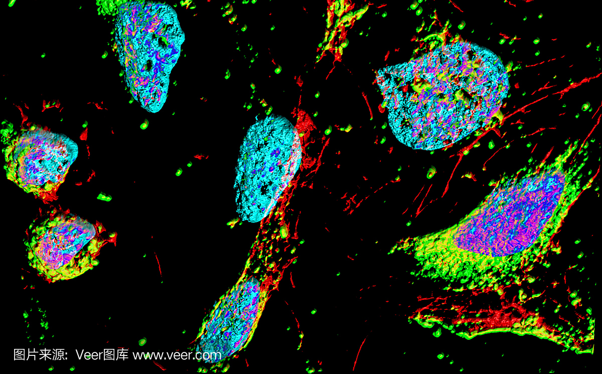 人宫颈癌传代细胞,海瑞埃塔细胞缺失,宫颈癌细