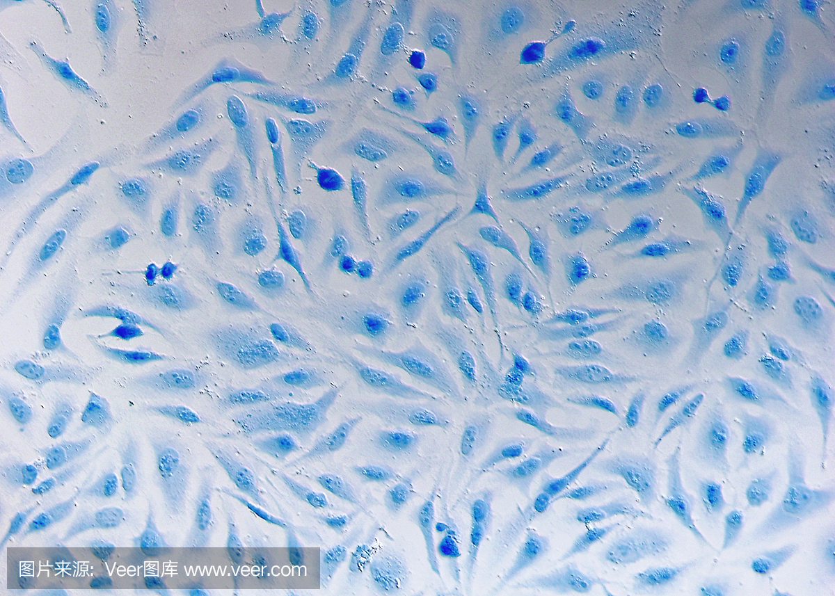 人宫颈癌传代细胞,宫颈癌细胞,海瑞埃塔细胞缺