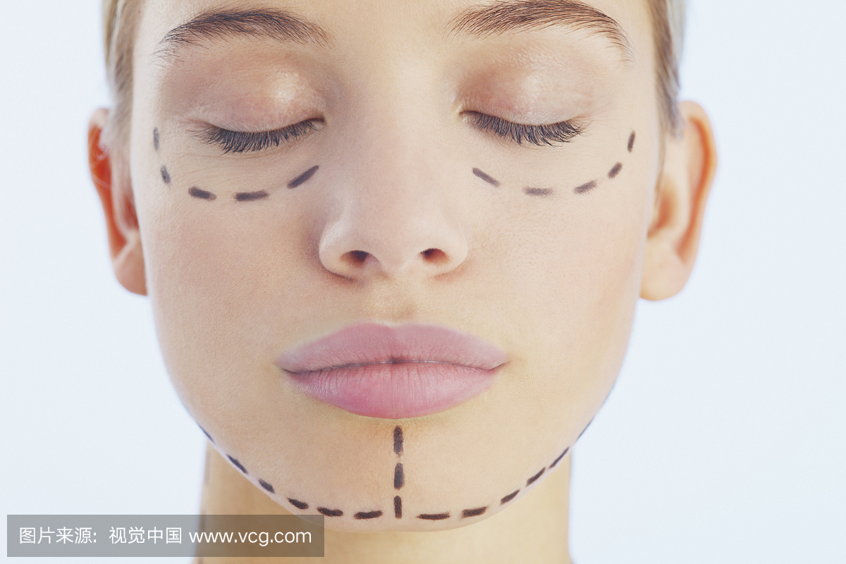 整形手术,植皮,微整,整容手术