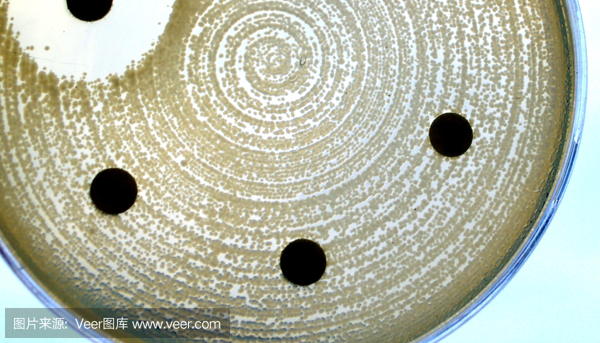 抗生素敏感性试验