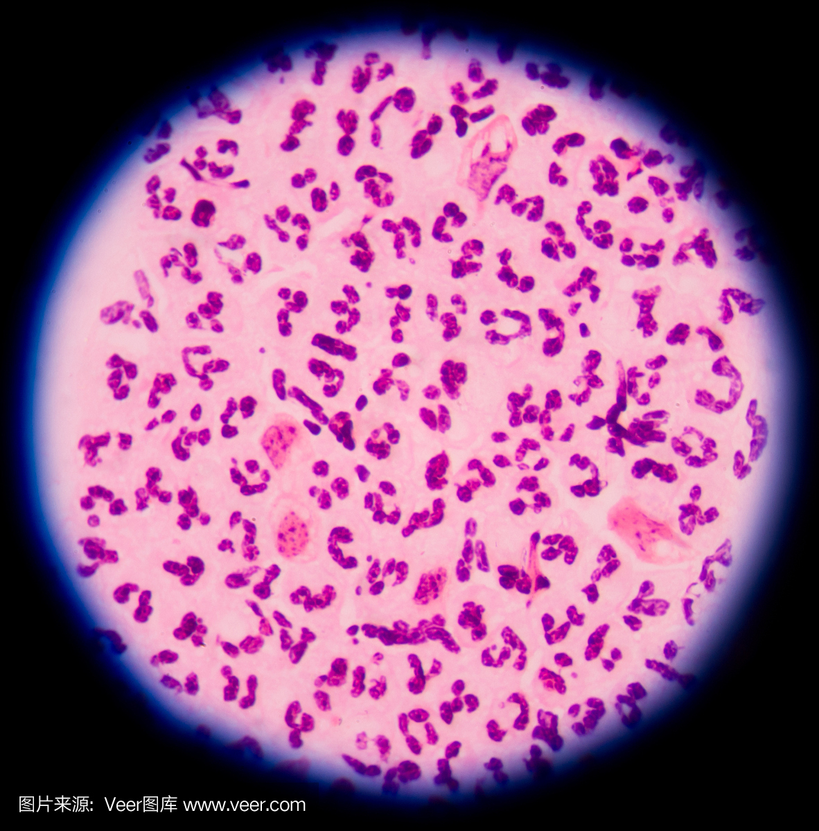 白血球在显微镜下在医学背景的概念。