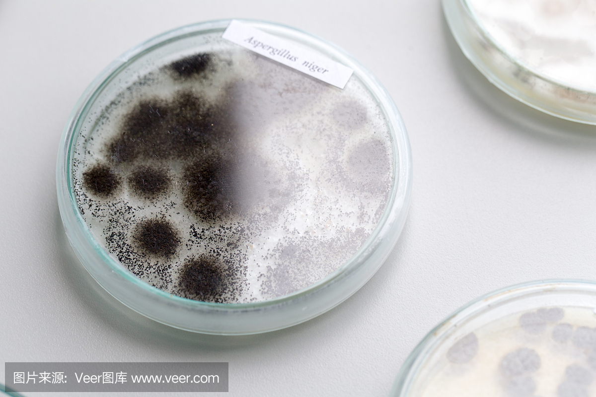 黑曲霉培养皿中的微观,微生物学教育实验室。