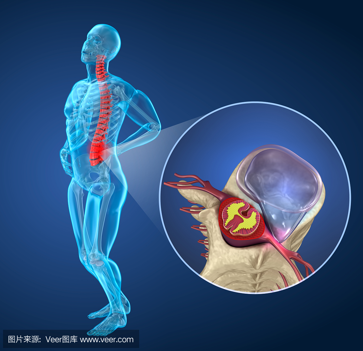 脊椎疼痛椎间盘突出后发作,男性患脊柱疼痛。