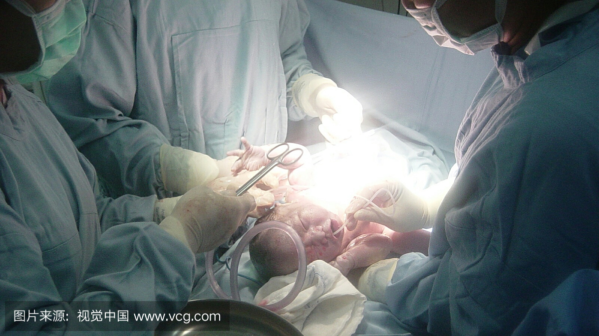 医生检查新生婴儿在医院