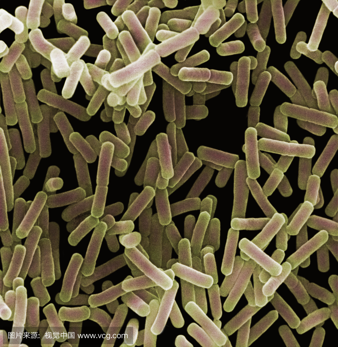 奇异变形杆菌是革兰氏阴性杆菌,其天然存在于
