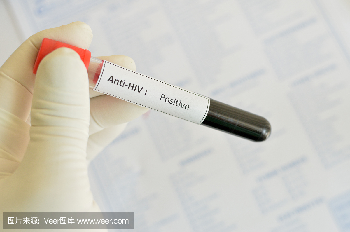 HIV阳性