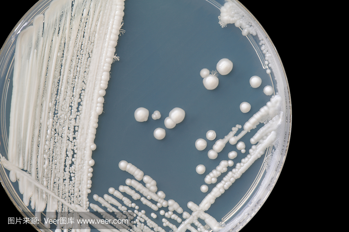 真菌菌落:白色念珠菌。