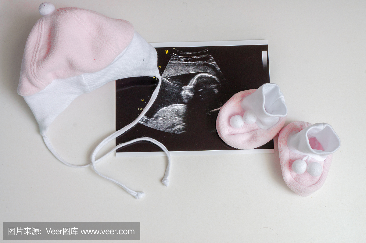 婴儿衣服和超声波照片。期望怀孕浓缩