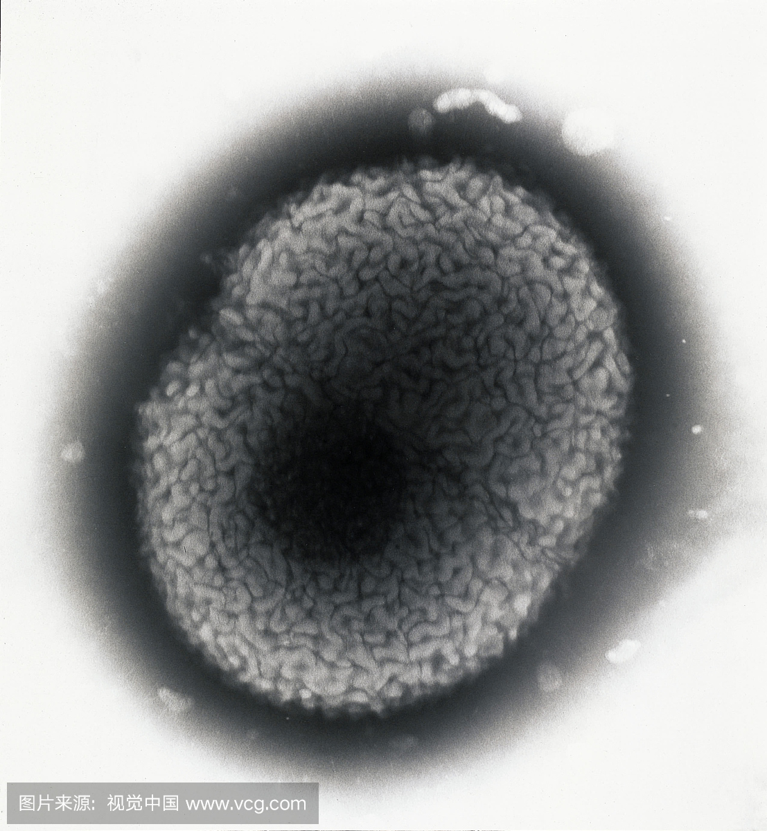 分离的淋病奈瑟氏球菌的阴性染色细胞,当用阴