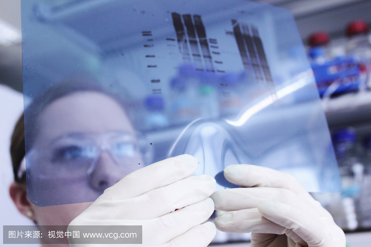 科学家在实验室检查PCR检测