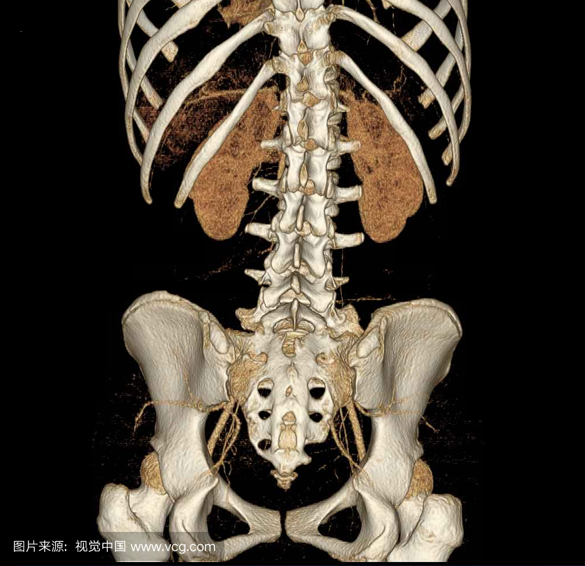CT检查,研究,人体结构,黑色背景