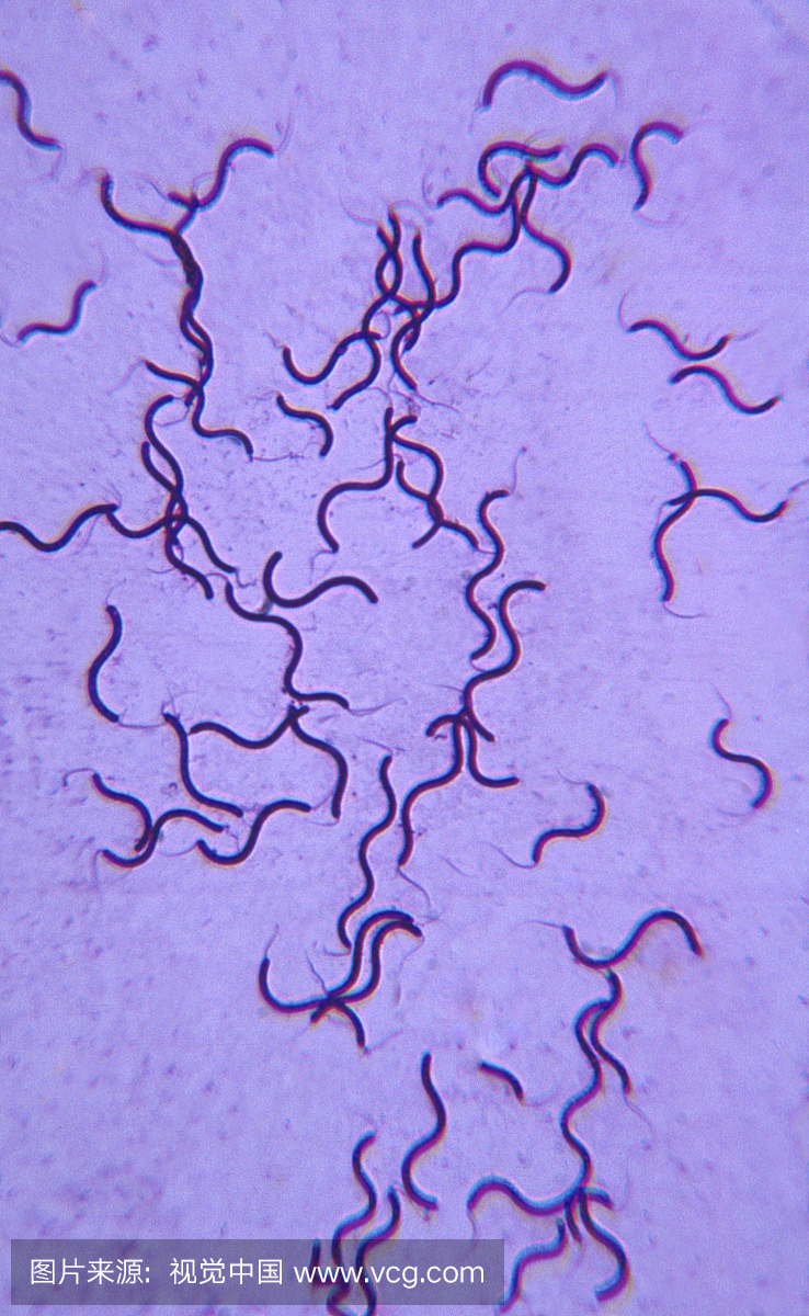 螺旋菌 - 螺旋卷蛾发现双极鞭毛250X