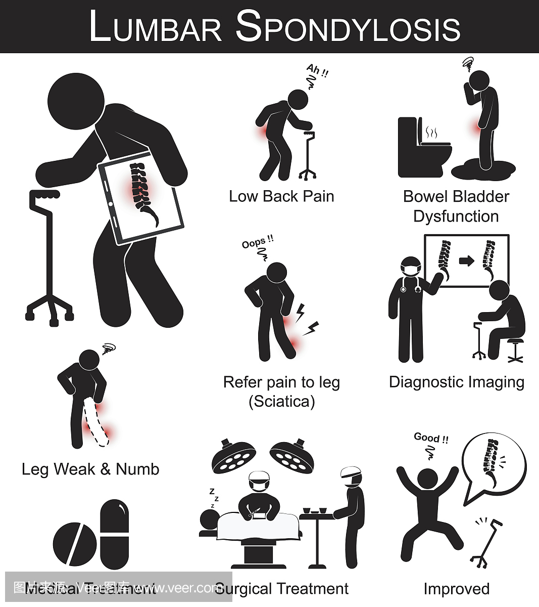 腰椎病症状象形图(腰背痛,指腿痛,腿部麻木和虚