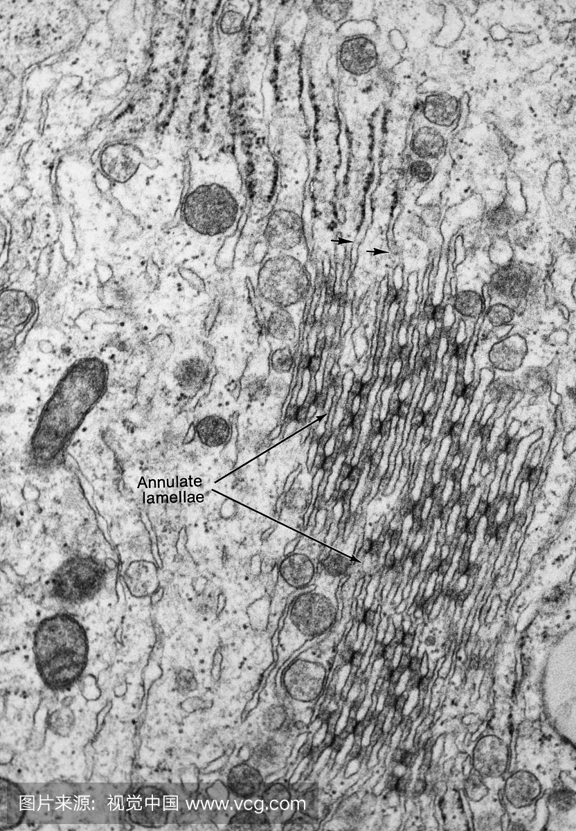 人类生精上皮细胞的星形片的透射电子显微镜照