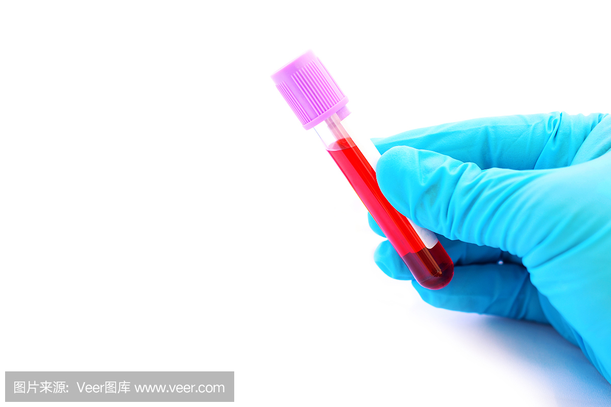血液样本管进行实验室检测
