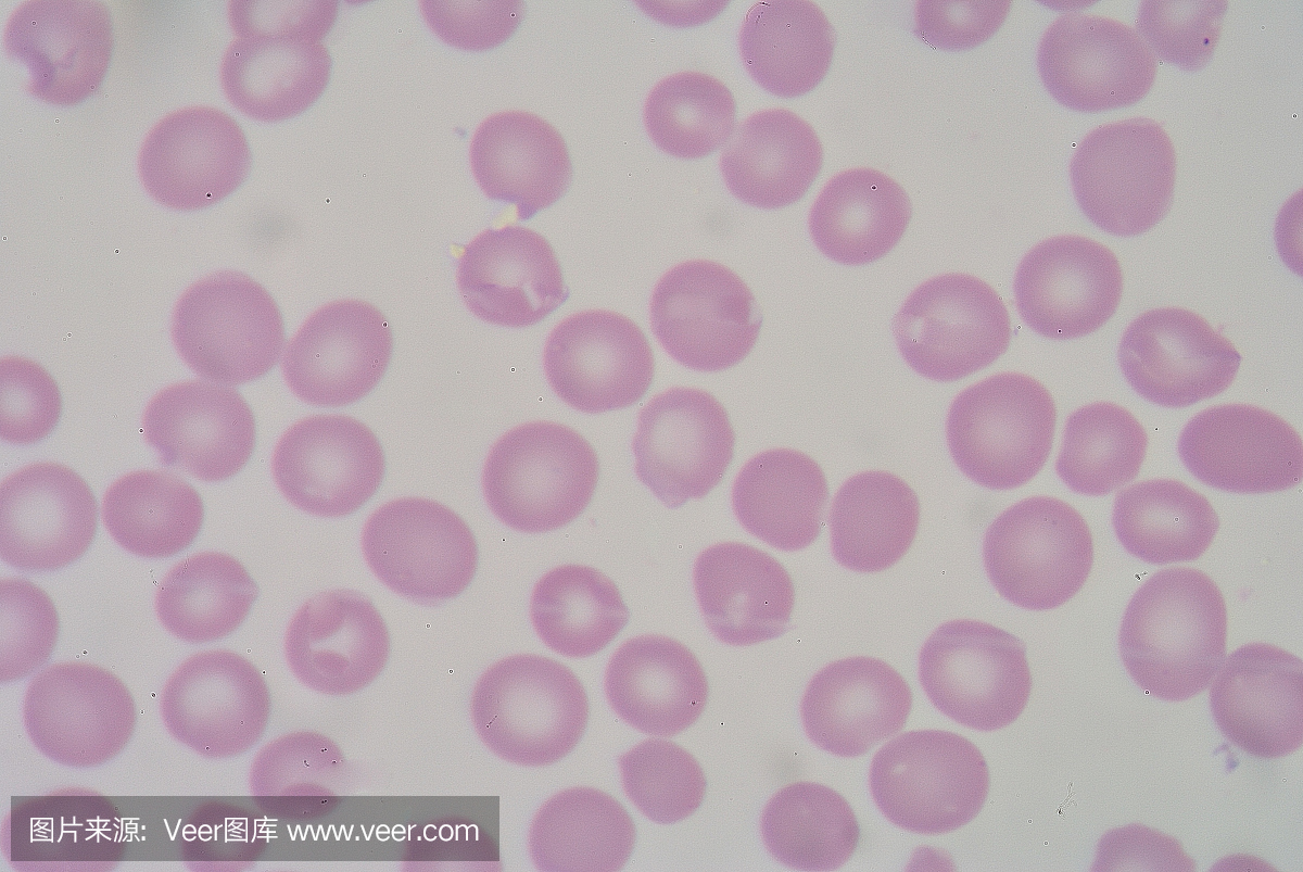 红细胞大红细胞