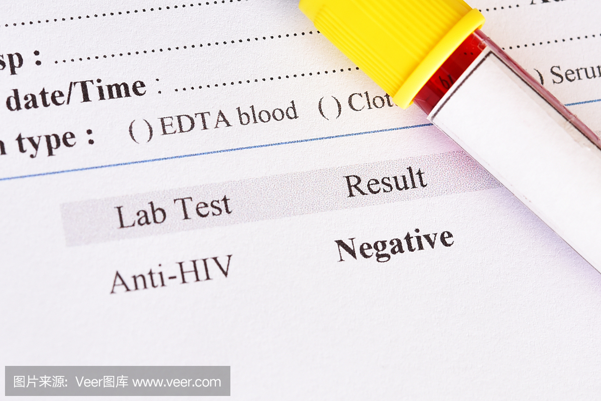 HIV阴性结果