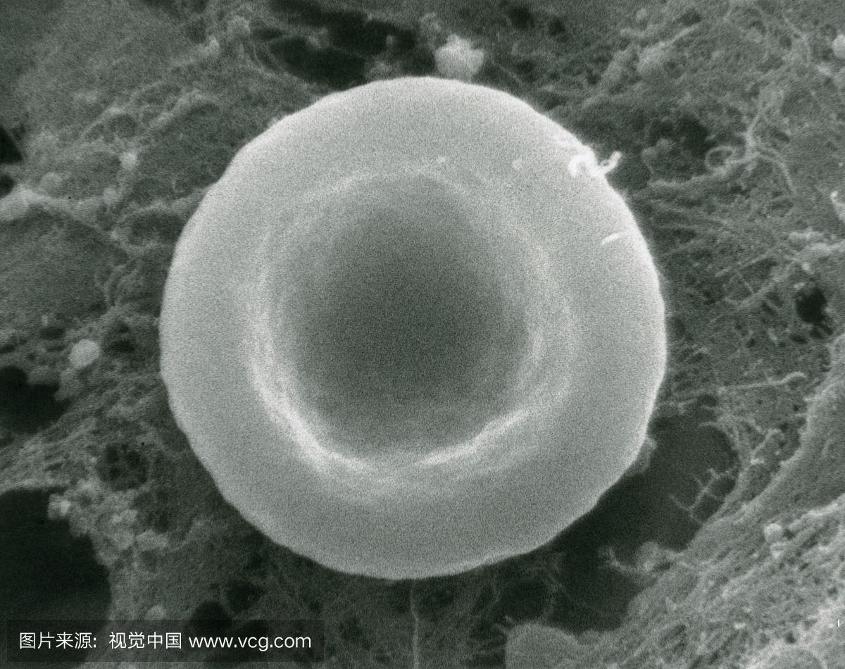 正常红细胞在等渗溶液中扫描电子显微镜照片显