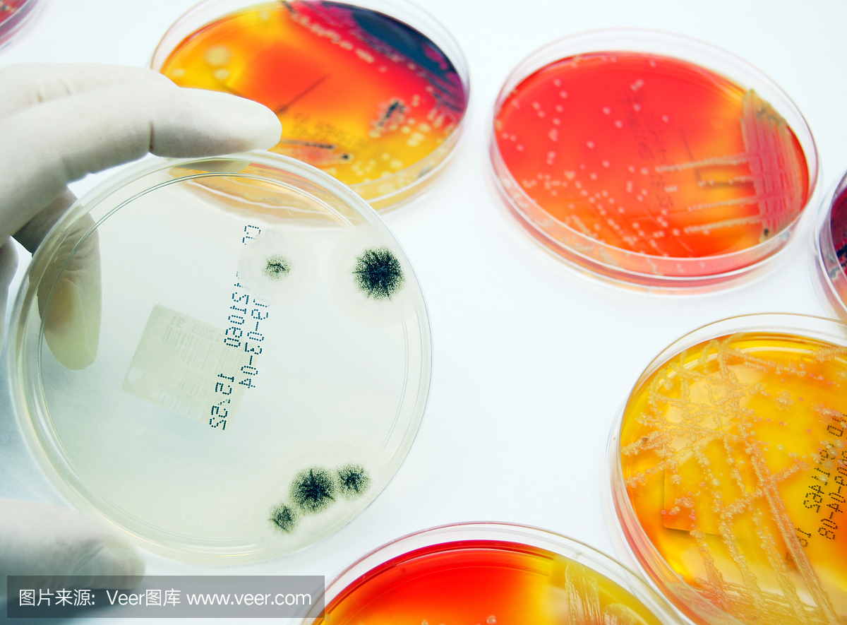 微生物学:真菌培养在前景,细菌板后面