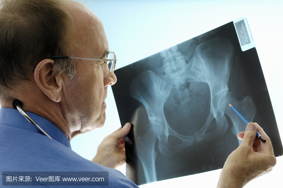 矫形外科医生咨询骨盆X线片进行髋关节置换。