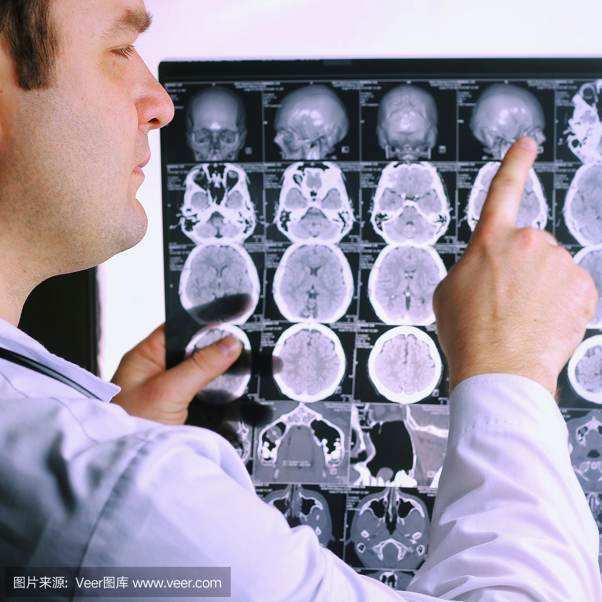 大脑的CT扫描。大脑的MRI。医生,看一台电脑