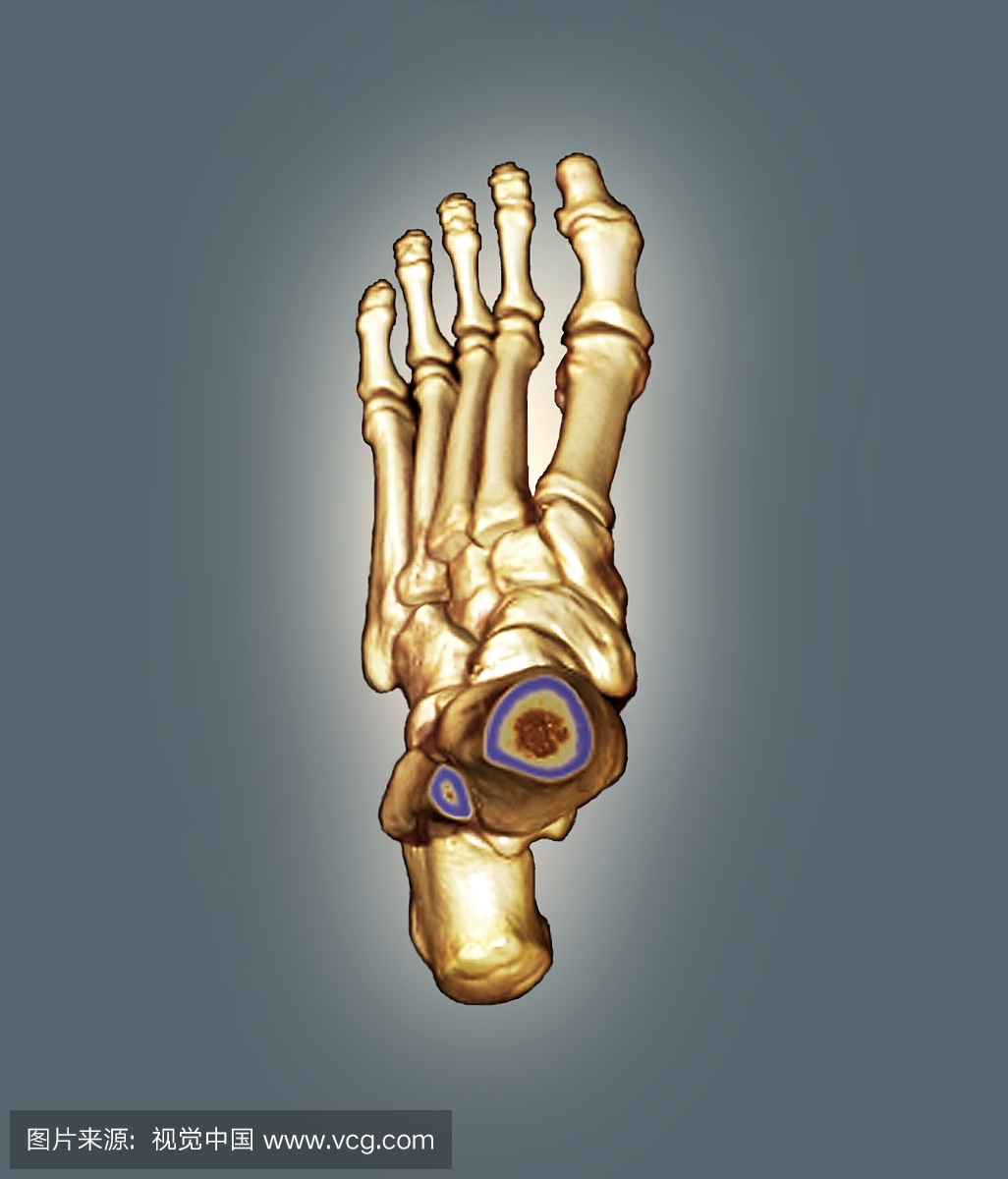 3D扫描,CT检查,建筑结构,人体结构