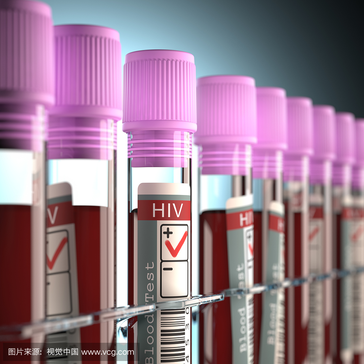 血液样本用于艾滋病毒检测,插图