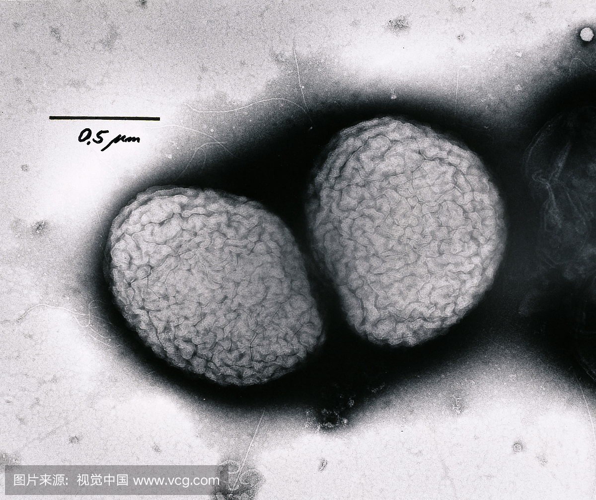 淋病奈瑟氏球菌的阴性染色细胞表现出双球菌和